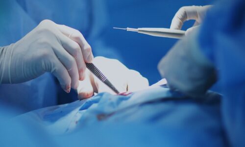 Bariatric Surgeon in Pune