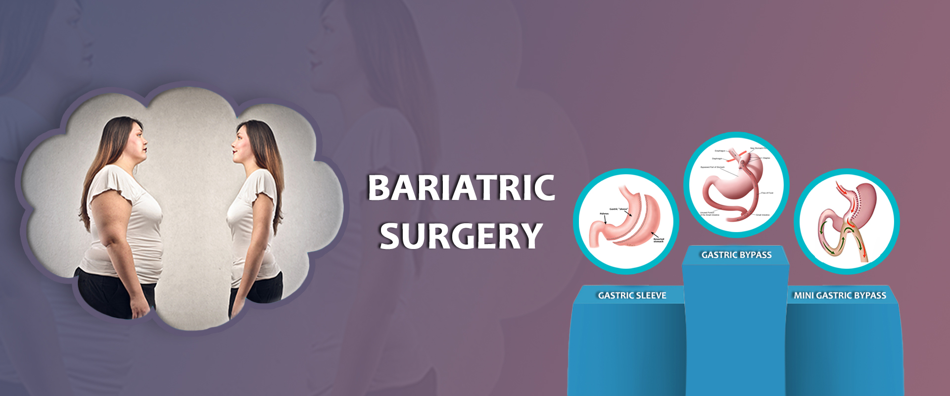 Bariatric Surgeon in Pune