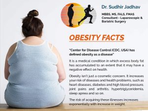 Bariatric & Weight Loss Surgery in Pune , Obesity Surgery in Pune