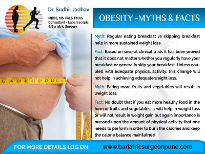 Myths and Facts of obesity