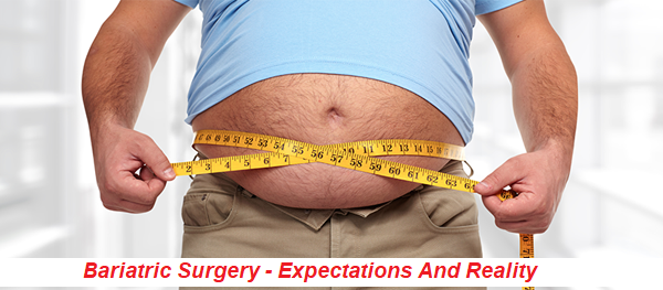 Post Bariatric Surgery - Expectations and reality Weight loss surgery in Pune