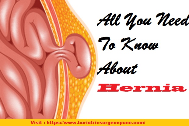 Hernia specialist in Pune